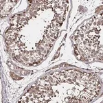 Merck Anti-SMYD3 antibody produced in rabbit
