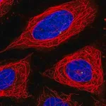 Merck Anti-ADPGK antibody produced in rabbit