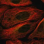 Merck Anti-STK32B antibody produced in rabbit