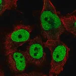 Merck Anti-TFPT antibody produced in rabbit