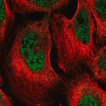 Merck Anti-DCPS antibody produced in rabbit