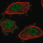 Merck Anti-NUDT2 antibody produced in rabbit