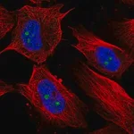 Merck Anti-RBM19 antibody produced in rabbit
