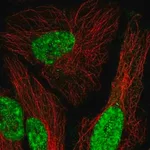 Merck Anti-MEIS1 antibody produced in rabbit