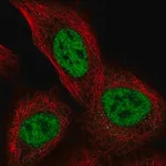 Merck Anti-TSSC4 antibody produced in rabbit