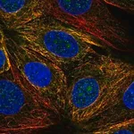 Merck Anti-NUDT14 antibody produced in rabbit