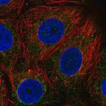 Merck Anti-BDH1 antibody produced in rabbit