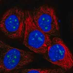 Merck Anti-RP11-849H4.2 antibody produced in rabbit