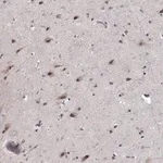 Merck Anti-TESPA1 antibody produced in rabbit