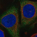 Merck Anti-PGGHG antibody produced in rabbit