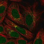 Merck Anti-PPP2R3C antibody produced in rabbit