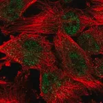 Merck Anti-WDR19 antibody produced in rabbit