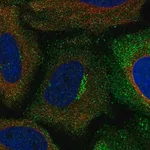 Merck Anti-ASIC1 antibody produced in rabbit