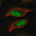 Merck Anti-CENPP antibody produced in rabbit
