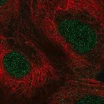 Merck Anti-PPARA antibody produced in rabbit