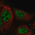 Merck Anti-RASGRP3 antibody produced in rabbit