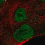 Merck Anti-OVCA2 antibody produced in rabbit
