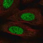 Merck Anti-CPEB3 antibody produced in rabbit