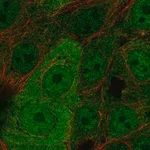 Merck Anti-WBP2 antibody produced in rabbit