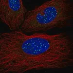 Merck Anti-TINF2 antibody produced in rabbit