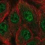 Merck Anti-CPSF1 antibody produced in rabbit