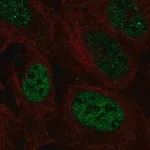 Merck Anti-PAX3 antibody produced in rabbit