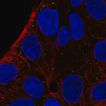 Merck Anti-ST3GAL5 antibody produced in rabbit