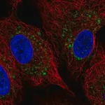 Merck Anti-ZDHHC11B antibody produced in rabbit