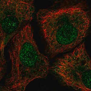 Merck Anti-TUT1 antibody produced in rabbit