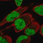 Merck Anti-MTF2 antibody produced in rabbit