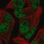 Merck Anti-PCGF1 antibody produced in rabbit