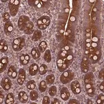Merck Anti-PIK3R2 antibody produced in rabbit