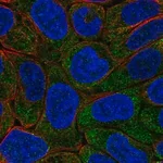 Merck Anti-EIF2B5 antibody produced in rabbit