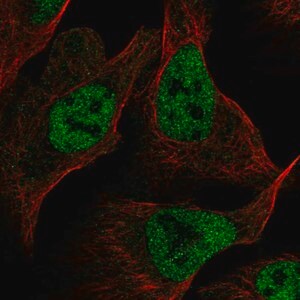 Merck Anti-RFC1 antibody produced in rabbit
