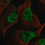 Merck Anti-RFC1 antibody produced in rabbit