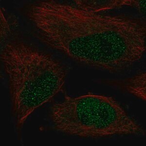 Merck Anti-POLK antibody produced in rabbit