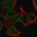 Merck Anti-LRR1 antibody produced in rabbit