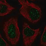 Merck Anti-CNOT7 antibody produced in rabbit