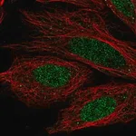 Merck Anti-CCDC36 antibody produced in rabbit