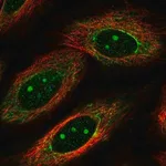 Merck Anti-DUSP1 antibody produced in rabbit