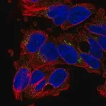 Merck Anti-SLC29A3 antibody produced in rabbit