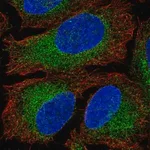 Merck Anti-HACE1 antibody produced in rabbit