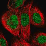Merck Anti-ERCC3 antibody produced in rabbit