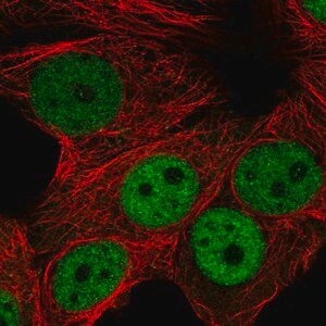 Merck Anti-RNF168 antibody produced in rabbit