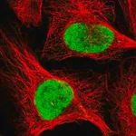 Merck Anti-RFC1 antibody produced in rabbit