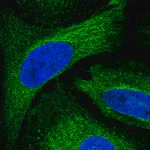 Merck Anti-ADAL antibody produced in rabbit