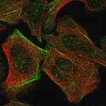 Merck Anti-TAX1BP3 antibody produced in rabbit