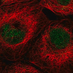 Merck Anti-ALKBH3 antibody produced in rabbit
