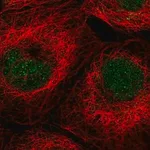 Merck Anti-ALKBH3 antibody produced in rabbit