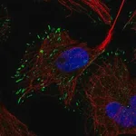 Merck Anti-RELN antibody produced in rabbit